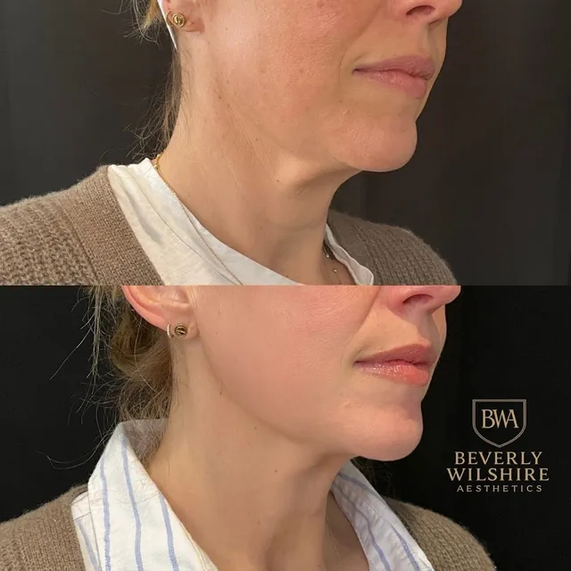 Beverly Wilshire Aesthetics Beverly Hills Medical Spa reviews