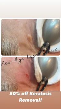 New Age Laser Clinic reviews