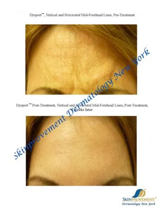 SkinProvement Dermatology New York reviews