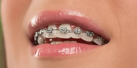Smile Dental Center Miami reviews