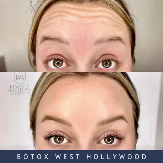 Beverly Wilshire Aesthetics Beverly Hills Medical Spa reviews