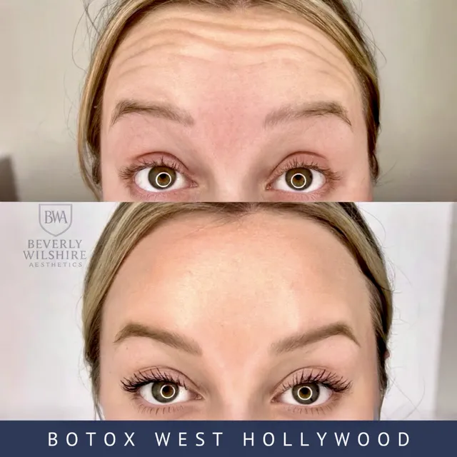 Beverly Wilshire Aesthetics Beverly Hills Medical Spa reviews