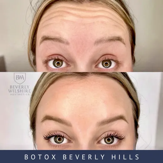 Beverly Wilshire Aesthetics Beverly Hills Medical Spa reviews